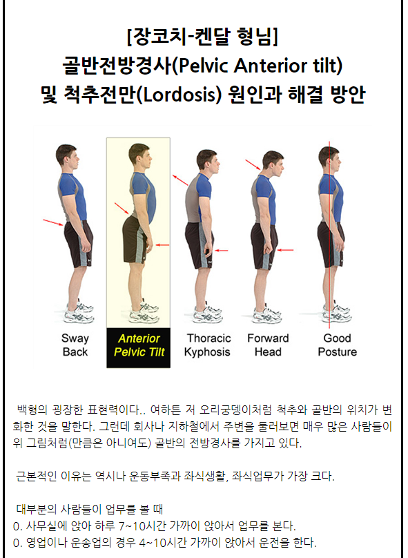 골반전방경사 및 오리궁뎅이? 얼른 오세요! 얼른! - 뽐뿌:건강/헬스 골반전방경사 및 오리궁뎅이? 얼른 오세요! 얼른!