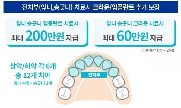 치아3.png